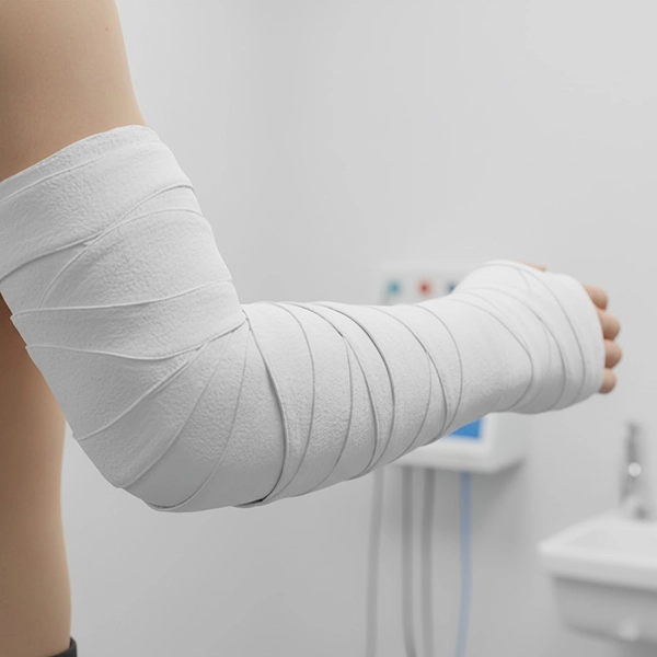 Examples of mistakes: pressure rings, irregular overlap, and wrinkles on a fiberglass cast